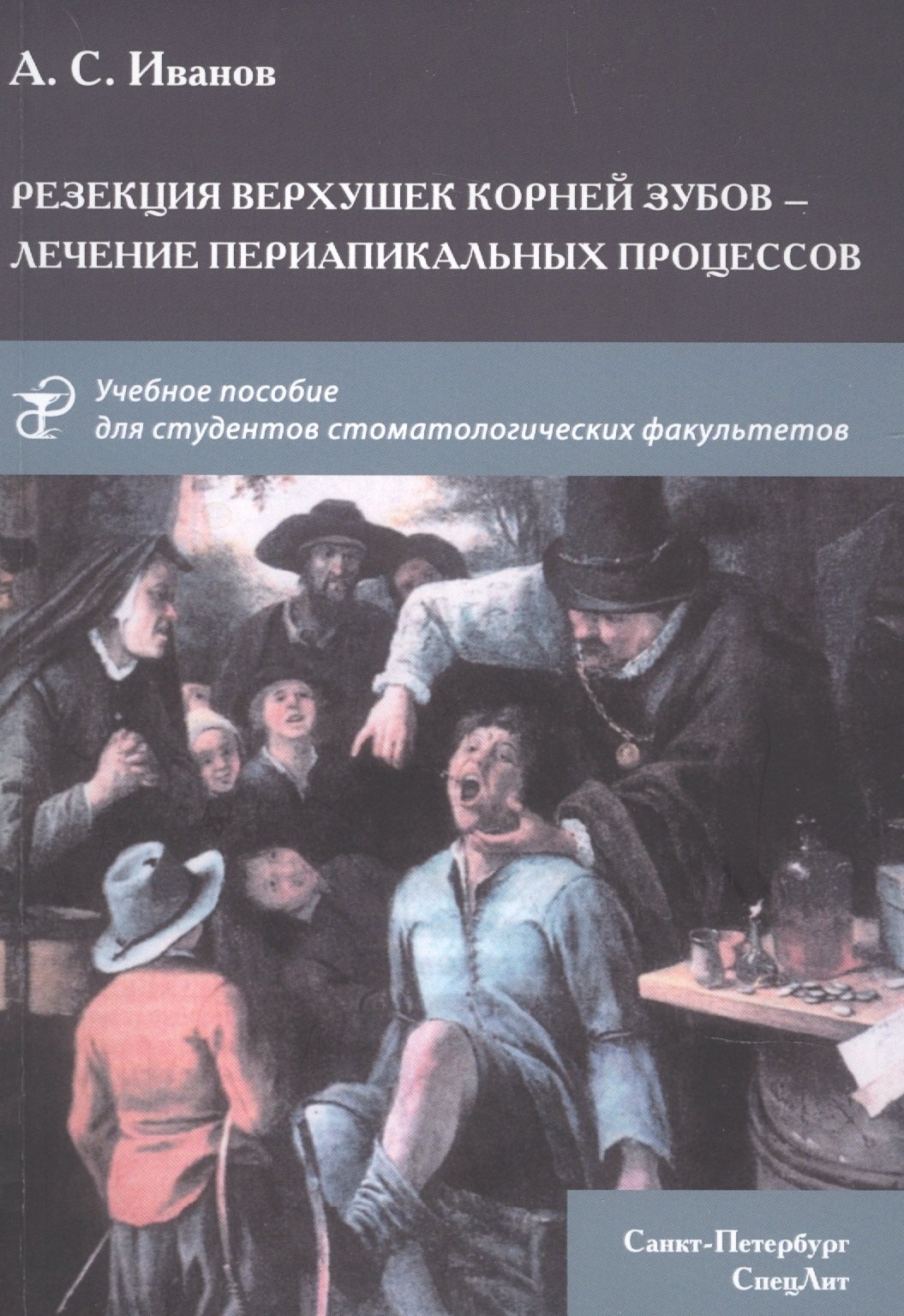 Резекция верхушек корней зубов - лечение периапикальных процессов